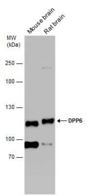 Western Blot: DPP6 Antibody [NBP3-13212] - Various tissue extracts (50 ug) were separated by 5% SDS-PAGE, and the membrane was blotted with DPP6 antibody (NBP3-13212) diluted at 1:1000.