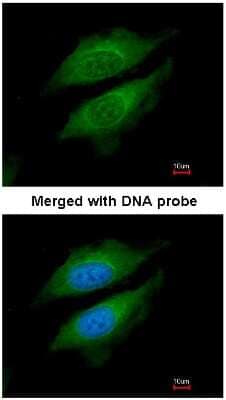 Immunocytochemistry/Immunofluorescence: DPP8 Antibody [NBP1-31256] - Analysis of HeLa, using DPRP1 antibody at 1:200 dilution.