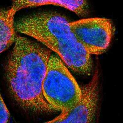 Immunocytochemistry/Immunofluorescence: DPP8 Antibody [NBP1-84993] - Staining of human cell line A-431 shows positivity in cytoplasm. Antibody staining is shown in green.