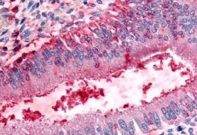 Immunohistochemistry-Paraffin: DPP8 Antibody [NB100-59023] - Analysis of anti-DPP8 antibody with human uterus at concentration 20 ug/ml.