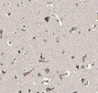 Immunohistochemistry-Paraffin: DPP8 Antibody [NBP1-84993] - Staining of human cerebral cortex shows weak to moderate cytoplasmic positivity in  meurons.