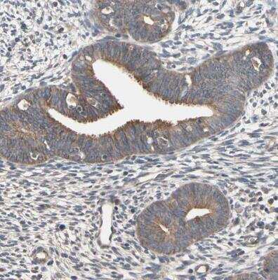 Immunohistochemistry-Paraffin: DPP8 Antibody [NBP1-84993] - Staining of human endometrium shows weak cytoplasmic positivity in glanular cells.