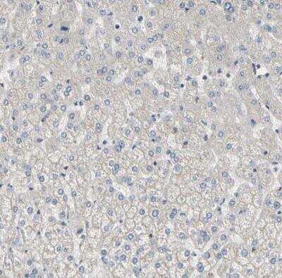 Immunohistochemistry-Paraffin: DPP8 Antibody [NBP1-84993] - Staining of human liver shows no positivity in hepatocytes as expected.