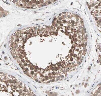 Immunohistochemistry-Paraffin: DPP8 Antibody [NBP1-84993] - Staining of human testis shows moderate cytoplasmic positivity in cells in seminiferous ducts.