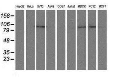 Western Blot: DPP8 Antibody (OTI1D2) - Azide and BSA Free [NBP2-71972] - Analysis of extracts (35ug) from 9 different cell lines by using anti-DPP8 monoclonal antibody.