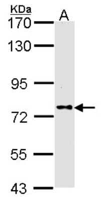 Western Blot: DPP8 Antibody [NBP1-31256] - Sample (30 ug of whole cell lysate) A: A431 7. 5% SDS PAGE DPP8 antibody, antibody diluted at 1:1000.