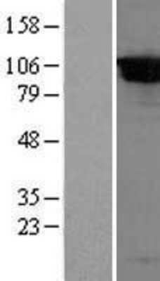 Western Blot: DPP8 Overexpression Lysate (Adult Normal) [NBL1-09999] Left-Empty vector transfected control cell lysate (HEK293 cell lysate); Right -Over-expression Lysate for DPP8.