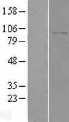 Western Blot: DPP8 Overexpression Lysate (Adult Normal) [NBL1-10000] Left-Empty vector transfected control cell lysate (HEK293 cell lysate); Right -Over-expression Lysate for DPP8.