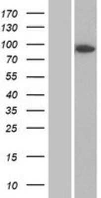 Western Blot: DPP8 Overexpression Lysate (Adult Normal) [NBP2-10075] Left-Empty vector transfected control cell lysate (HEK293 cell lysate); Right -Over-expression Lysate for DPP8.