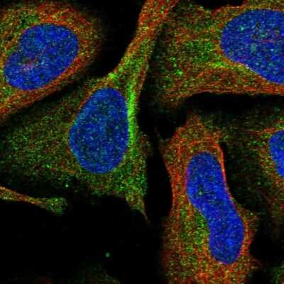 Immunocytochemistry/Immunofluorescence: DPP9 Antibody [NBP1-89492] - Immunofluorescent staining of human cell line U-2 OS shows localization to cytosol.