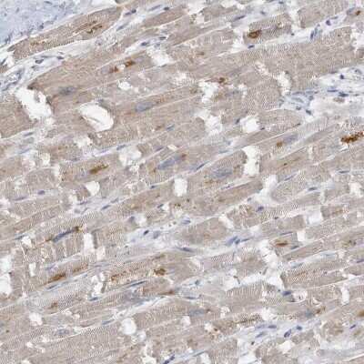 Immunohistochemistry-Paraffin: DPP9 Antibody [NBP1-89492] - Staining of human heart muscle shows weak cytoplasmic positivity in cardiomyocytes.