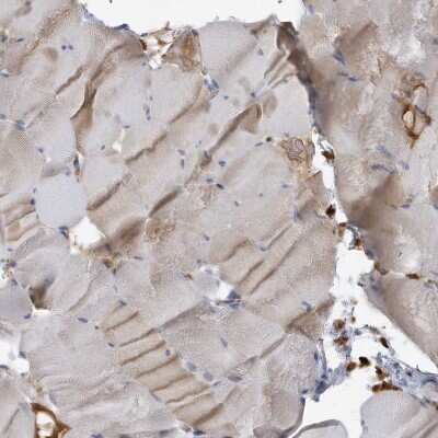 Immunohistochemistry-Paraffin: DPP9 Antibody [NBP1-89492] - Staining of human skeletal muscle shows moderate cytoplasmic positivity in myocytes.