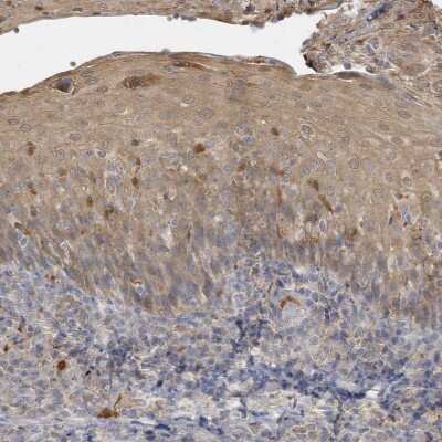 Immunohistochemistry-Paraffin: DPP9 Antibody [NBP1-89492] - Staining of human tonsil shows moderate cytoplasmic positivity in squamous epithelial cells.