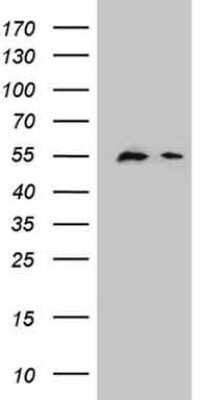 Western Blot: DPPA2 Antibody (OTI1G10) - Azide and BSA Free [NBP2-72426] - Analysis of HEK293T cells were transfected with the pCMV6-ENTRY control (Left lane) or pCMV6-ENTRY DPPA2.