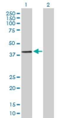 Western Blot: DPPA2 Antibody [H00151871-B01P] - Analysis of DPPA2 expression in transfected 293T cell line by DPPA2 polyclonal antibody.  Lane 1: DPPA2 transfected lysate(32.78 KDa). Lane 2: Non-transfected lysate.