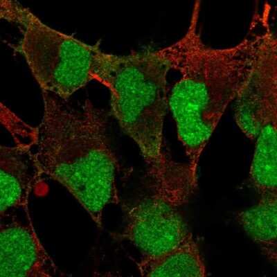 Immunocytochemistry/Immunofluorescence: DPPA4 Antibody [NBP2-48633] - Staining of human cell line AF22 shows localization to nucleus, nucleoli & plasma membrane.