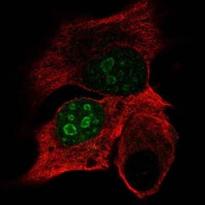 Immunocytochemistry/Immunofluorescence: DPPA4 Antibody [NBP2-48634] - Staining of human cell line PC-3 shows localization to nucleus & nucleoli. Antibody staining is shown in green.