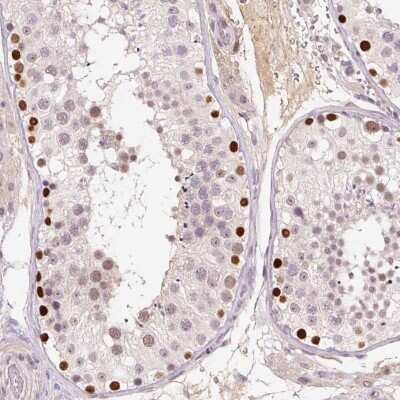 Immunohistochemistry-Paraffin: DPPA4 Antibody [NBP2-48633] - Staining of human testis shows nuclear positivity in seminiferous ducts.