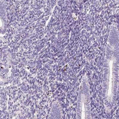 Immunohistochemistry-Paraffin: DPPA4 Antibody [NBP2-48634] - Staining of human endometrium shows low expression as expected.