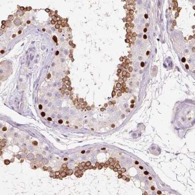 Immunohistochemistry-Paraffin: DPPA4 Antibody [NBP2-48634] - Staining of human testis shows high expression.