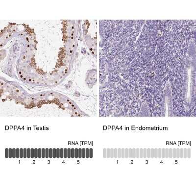 <b>Orthogonal Strategies Validation. </b>Immunohistochemistry-Paraffin: DPPA4 Antibody [NBP2-48634] - Staining in human testis and endometrium tissues using anti-DPPA4 antibody. Corresponding DPPA4 RNA-seq data are presented for the same tissues.