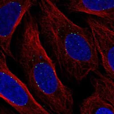 Immunocytochemistry/Immunofluorescence: DPY19L1 Antibody [NBP2-31748] - Staining of human cell line U-2 OS shows localization to vesicles.