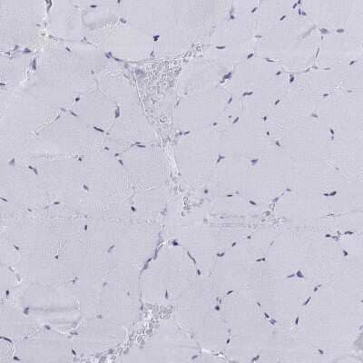 Immunohistochemistry-Paraffin DPY19L2 Antibody - BSA Free