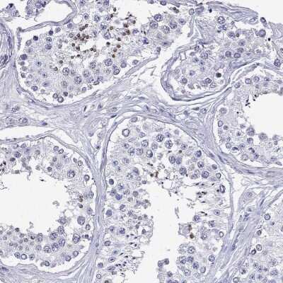 Immunohistochemistry-Paraffin DPY19L2 Antibody - BSA Free