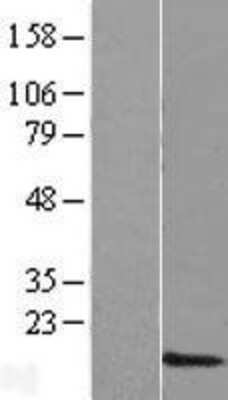 Western Blot: DPY19L3 Overexpression Lysate (Adult Normal) [NBL1-13072] Left-Empty vector transfected control cell lysate (HEK293 cell lysate); Right -Over-expression Lysate for DPY19L3.