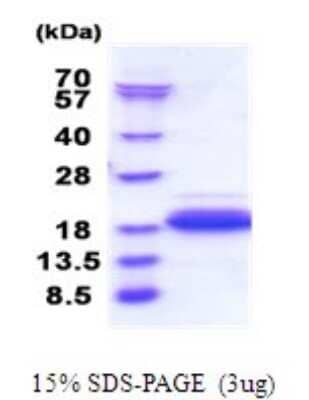 SDS-PAGE Recombinant Human DPY30 His Protein