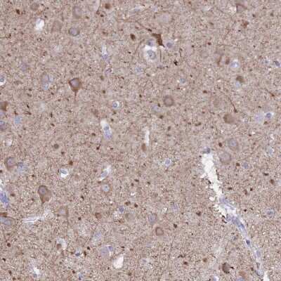 Immunohistochemistry-Paraffin: DPYD Antibody [NBP2-37911] - Staining of human cerebral cortex shows moderate cytoplasmic positivity in neuronal cells.