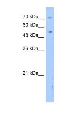 Western Blot: DPYS Antibody [NBP1-55121] - Titration: 2.5ug/ml Positive Control: Transfected 293T.