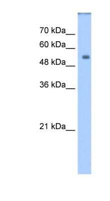 Western Blot: DPYS Antibody [NBP1-55122] - Transfected 293T cell lysate, concentration 1.25ug/ml.