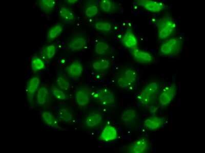 Immunocytochemistry/Immunofluorescence: DR1 Antibody [NBP2-92857] - Analysis of MCF7 cells using DR1 .