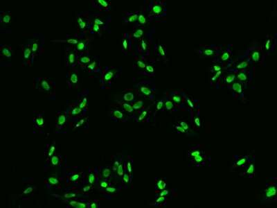 Immunocytochemistry/Immunofluorescence: DR1 Antibody [NBP2-97557] - Immunofluorescence staining of DR1 in PC3 cells. Cells were fixed with 4% PFA, permeabilzed with 0.1% Triton X-100 in PBS, blocked with 10% serum, and incubated with rabbit anti-Human DR1 polyclonal antibody (dilution ratio 1:200) at 4C overnight. Then cells were stained with the Alexa Fluor(R)488-conjugated Goat Anti-rabbit IgG secondary antibody (green). Positive staining was localized to Nucleus.