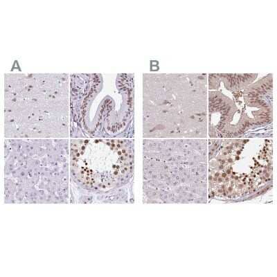 <b>Independent Antibodies Validation and Orthogonal Strategies Validation.</b>Immunohistochemistry-Paraffin: DR1 Antibody [NBP2-47480] - Staining of human cerebral cortex, gallbladder, liver and testis using Anti-DR1 antibody NBP2-47480 (A) shows similar protein distribution across tissues to independent antibody NBP2-48979 (B).