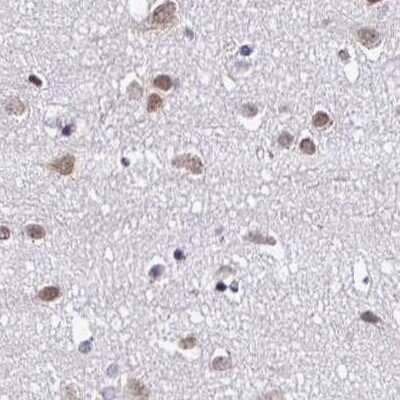 Immunohistochemistry-Paraffin: DR1 Antibody [NBP2-47480] - Staining of human cerebral cortex.