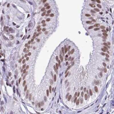 Immunohistochemistry-Paraffin: DR1 Antibody [NBP2-47480] - Staining of human gallbladder.