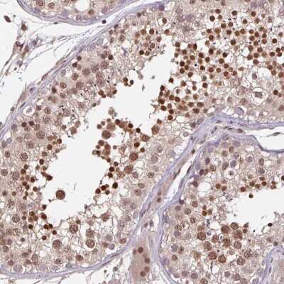 Immunohistochemistry-Paraffin: DR1 Antibody [NBP2-48979] - Staining of human testis shows high expression.