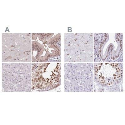 <b>Independent Antibodies Validation. </b>Immunohistochemistry-Paraffin: DR1 Antibody [NBP2-48979] - Staining of human cerebral cortex, gallbladder, liver and testis using Anti-DR1 antibody NBP2-48979 (A) shows similar protein distribution across tissues to independent antibody NBP2-47480 (B).