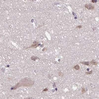 Immunohistochemistry-Paraffin: DR1 Antibody [NBP2-48979] - Staining of human cerebral cortex.