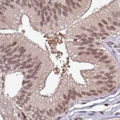 Immunohistochemistry-Paraffin: DR1 Antibody [NBP2-48979] - Staining of human gallbladder.