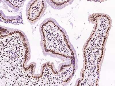 Immunohistochemistry-Paraffin: DR1 Antibody [NBP2-97557] - Immunochemical staining of human DR1 in human gallbladder with rabbit polyclonal antibody at 1:200 dilution, formalin-fixed paraffin embedded sections.