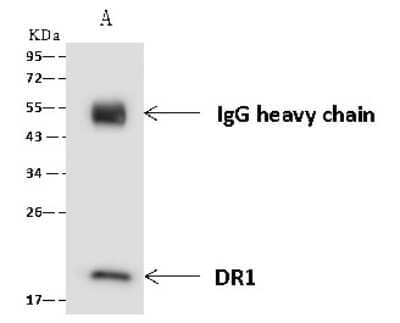 Immunoprecipitation: DR1 Antibody [NBP2-97557] - DR1 was immunoprecipitated using: Lane A: 0.5 mg Jurkat Whole Cell Lysate 4 ul anti-DR1 rabbit polyclonal antibody and 60 ug of Immunomagnetic beads Protein A/G.  Primary antibody: Anti-DR1 rabbit polyclonal antibody, at 1:100 dilution. Secondary antibody: Goat Anti-Rabbit IgG (H+L)/HRP at 1/10000 dilution. Developed using the ECL technique. Performed under reducing conditions. Predicted band size: 19 kDa. Observed band size: 19 kDa