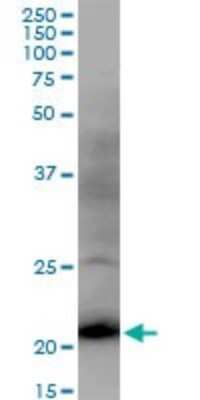 Western Blot: DR1 Antibody [H00001810-B01P] - Analysis of DR1 expression in PC-12.
