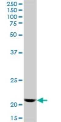 Western Blot: DR1 Antibody [H00001810-B01P] - Analysis of DR1 expression in Hela S3 NE.