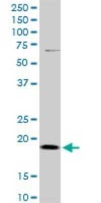 Western Blot: DR1 Antibody [H00001810-B01P] - Analysis of DR1 expression in Jurkat.