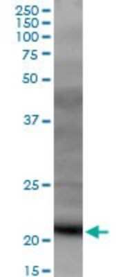 Western Blot: DR1 Antibody [H00001810-B01P] - Analysis of DR1 expression in NIH/3T3.