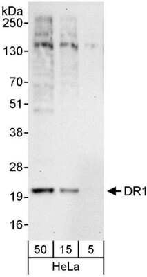 Western Blot: DR1 Antibody [NBP1-03329] - Whole cell lysate (5, 15 and 50 ug) from HeLa cells. Antibody used at 1 ug/ml.