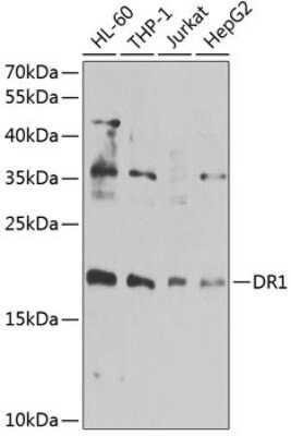 Western Blot: DR1 Antibody [NBP2-92906] - Analysis of extracts of various cell lines, using DR1 at 1:1000 dilution.Secondary antibody: HRP Goat Anti-Rabbit IgG (H+L) at 1:10000 dilution.Lysates/proteins: 25ug per lane.Blocking buffer: 3% nonfat dry milk in TBST.Detection: ECL Basic Kit .Exposure time: 30s.